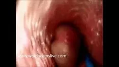 चलाएँ इंट्राम्यूरल कमस्ट्रोक - कैम आंतरिक योनि